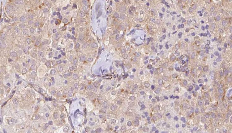 TCTN2 Antibody
