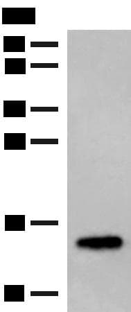 LYRM1 Antibody
