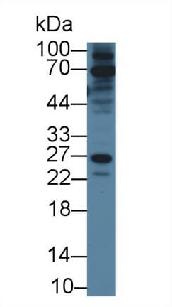 RAB37 Antibody (aa19-220, APC)