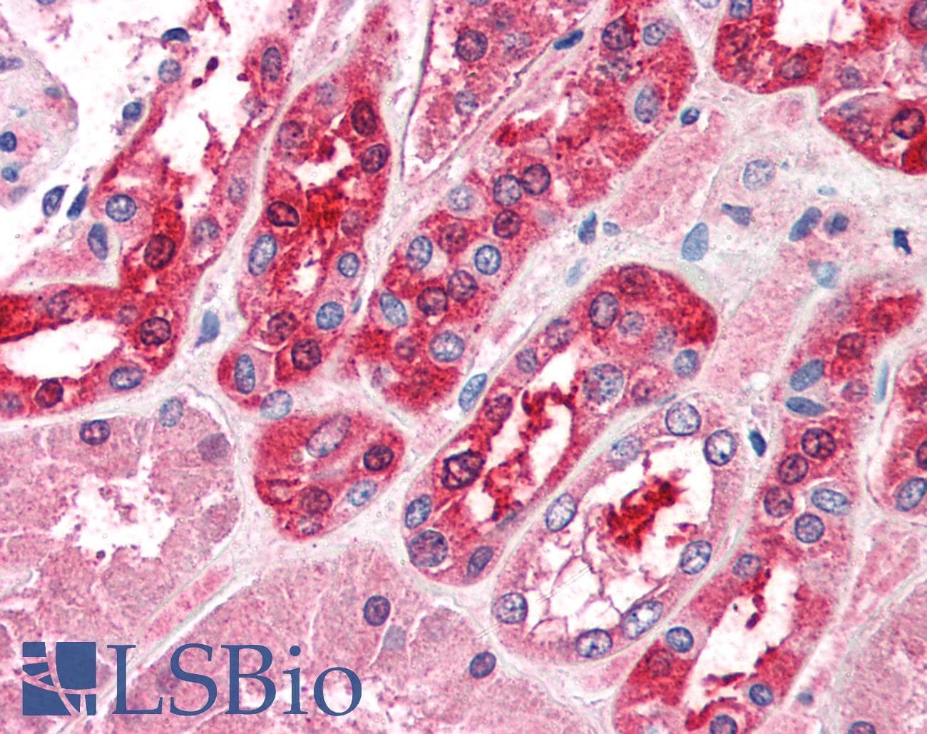 IHC-plus™ TRIM1 / MID2 Antibody (aa723-735)