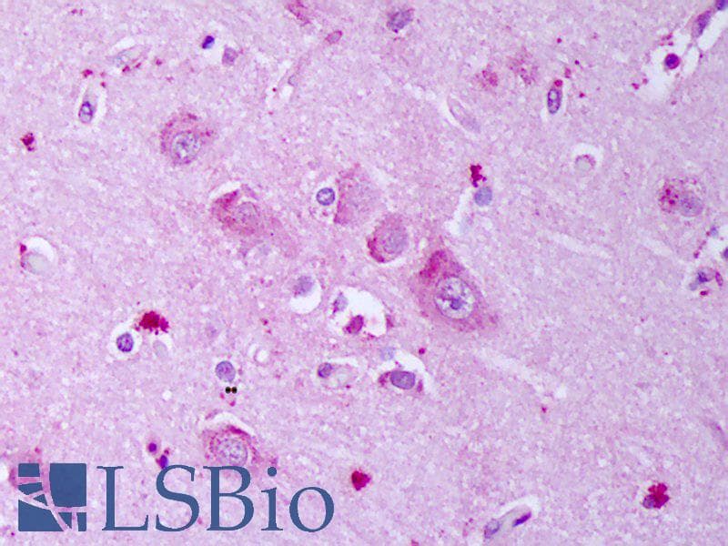 IHC-plus™ GABRA1 Antibody (aa327-450, clone S96-55)