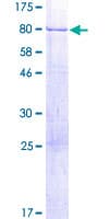 Human TSPYL1 Protein (Recombinant GST)