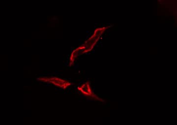 Polyclonal Rabbit anti-Human Tyrosinase Antibody (IHC, IF, WB)
