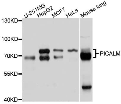 Polyclonal Rabbit anti-Human PICALM / CALM Antibody (WB)