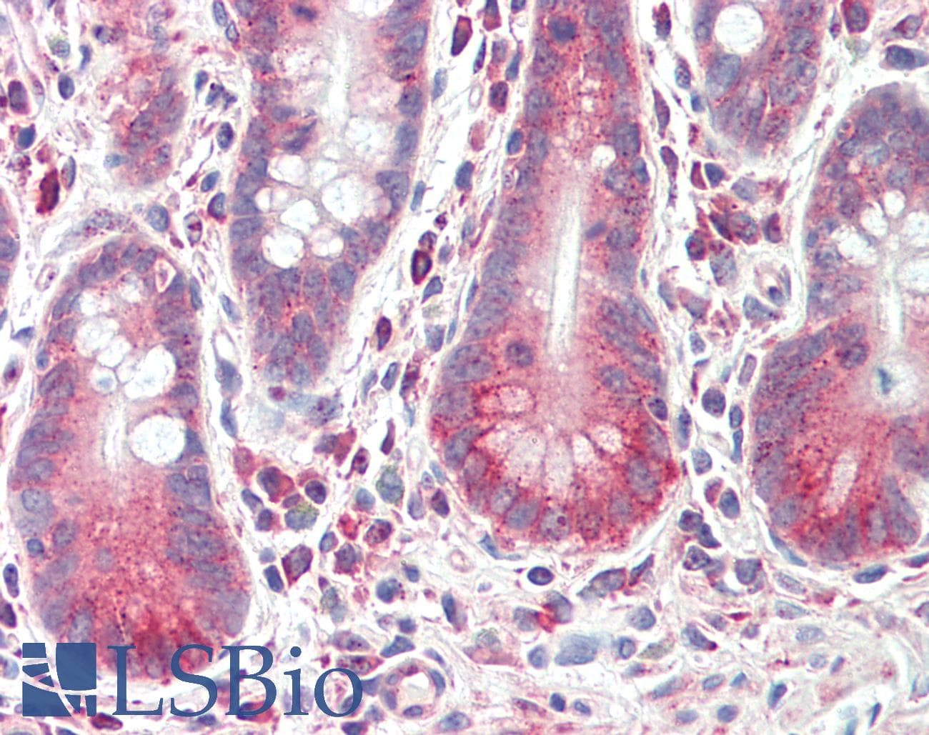 LRRK1 Antibody (aa474-523)