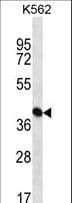 PAICS / ADE2 Antibody (aa95-123)