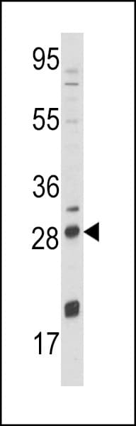 Polyclonal Rabbit anti-Human NGF Antibody (aa84-115, IHC, IF, WB)