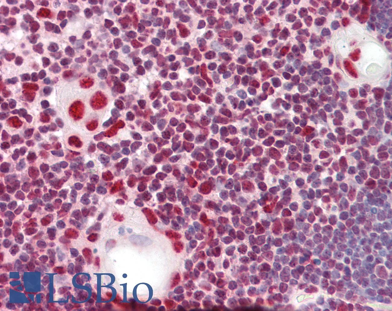 PathPlus™ HNRNPK / hnRNP K Antibody (aa200-250)