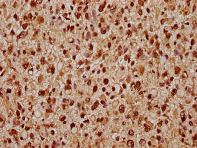 PARP7 / TIPARP Antibody