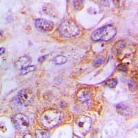 NIN / Ninein Antibody