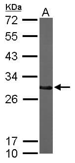 CTDSP2 Antibody (aa26-271)