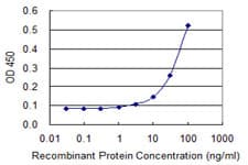 GK2 / Glycerol Kinase 2 Antibody (clone 3G4)