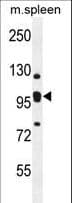 EMC1 Antibody (aa866-894)