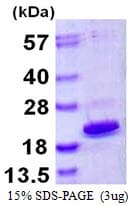 Human HMGIY / HMGA1 Protein (Recombinant His)