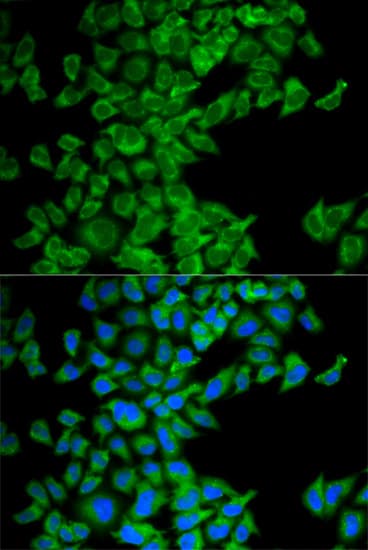 DIABLO / SMAC Antibody