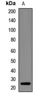 NDUFS7 Antibody