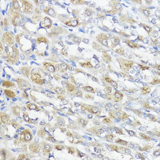 Polyclonal Rabbit anti-Human GPX2 Antibody (IHC)