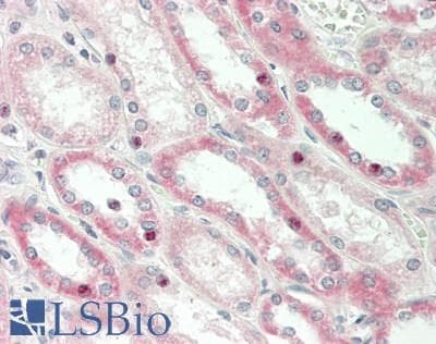 IHC-plus™ MCAD / ACADM Antibody