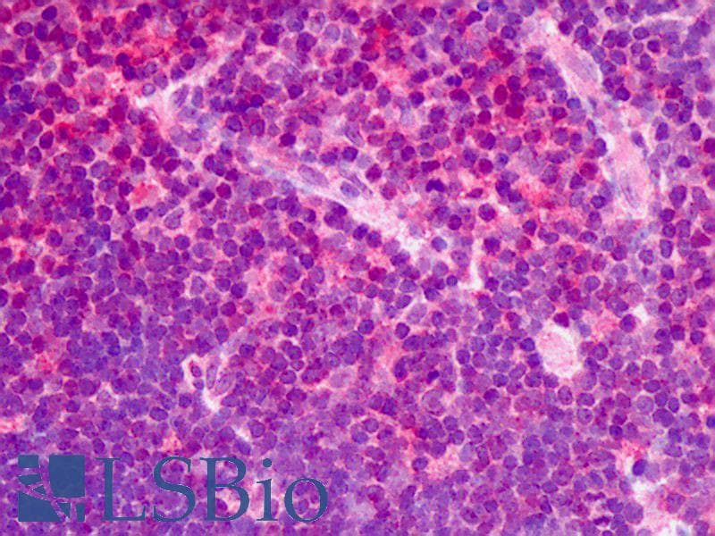 IHC-plus™ RAD51 / RECA Antibody (clone 13E4, Preservative Free)