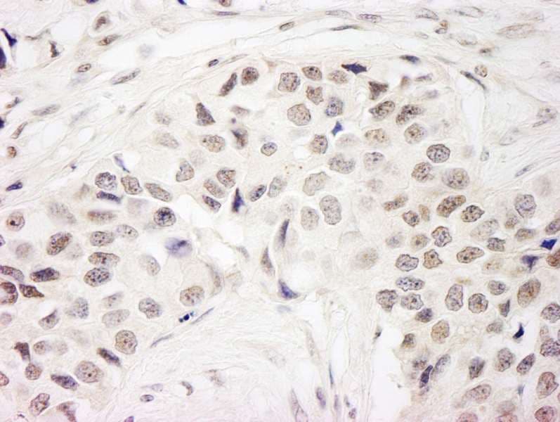 NSL1 Antibody (aa150-200)