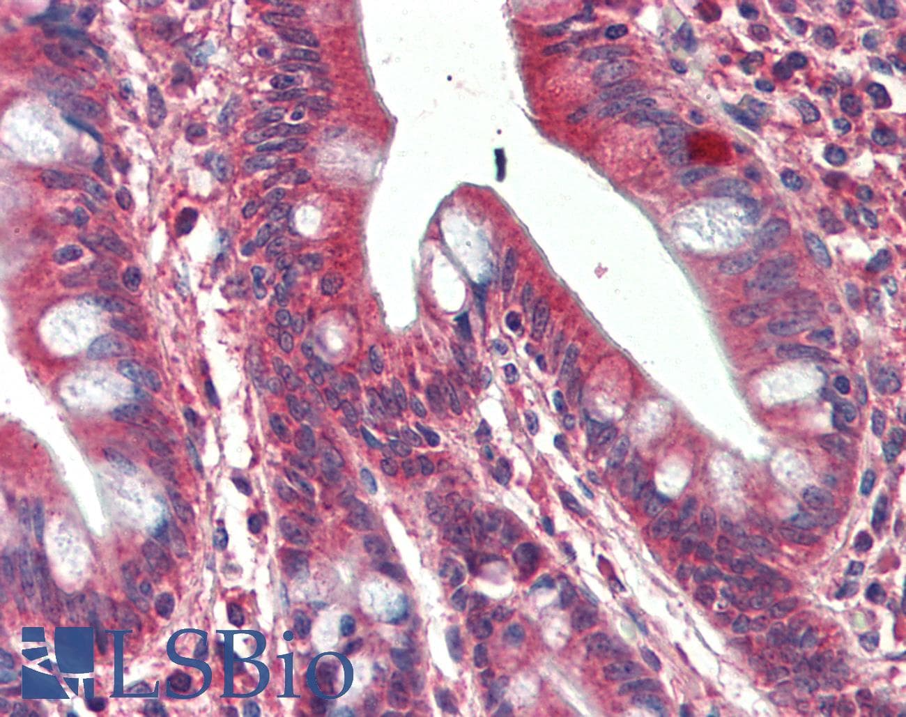 IHC-plus™ SH3GL1 / EEN Antibody (aa261-272)