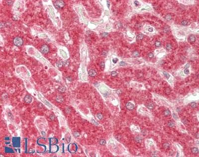 IHC-plus™ Polyclonal Rabbit anti-Human HOXD12 Antibody (C-Terminus, IHC, WB)