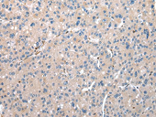 Polyclonal Rabbit anti-Human DCAF7 / WDR68 Antibody (IHC, WB)