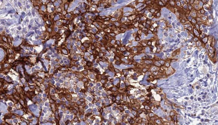 AQP8 / Aquaporin 8 Antibody