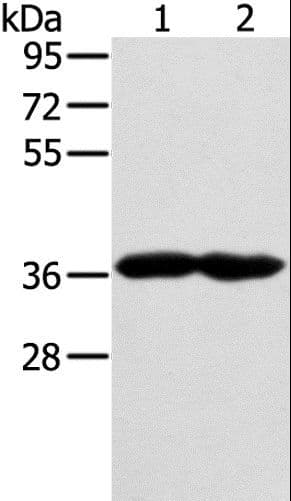 GNAT3 / Gustducin Antibody