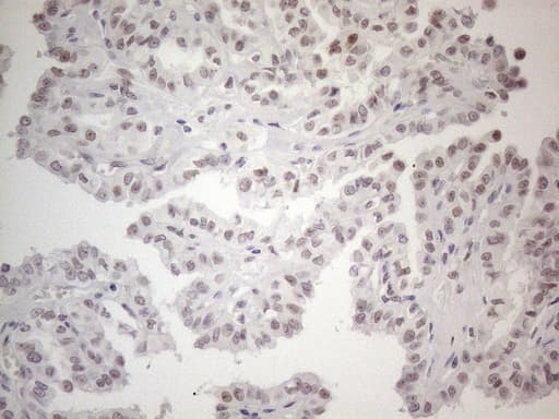 TDG / Thymine DNA Glycosylase Antibody (aa160-253, clone OTI3C11)