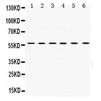 UPF3B Antibody (aa416-452)