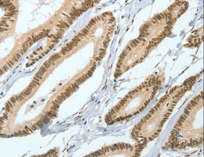 ASH2L / ASH2 Antibody