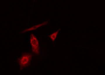 Polyclonal Rabbit anti-Human PFKL Antibody (IF, WB)