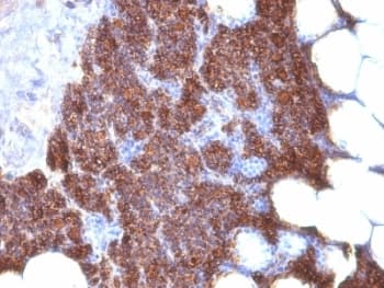 PTH / Parathyroid Hormone Antibody (aa1-34, clone 3H9 + PTH/1175, Ready-to-Use)