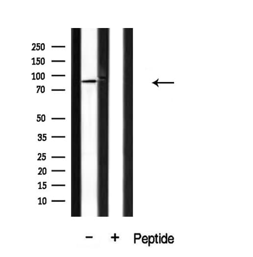 CAGE1 / Cancer Antigen 1 Antibody