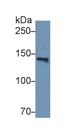 HYOU1 / ORP150 Antibody (aa695-994)
