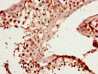 RAB25 Antibody