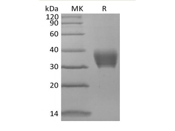 Mouse BTN3A3 Protein (Recombinant 6His, C-terminus)