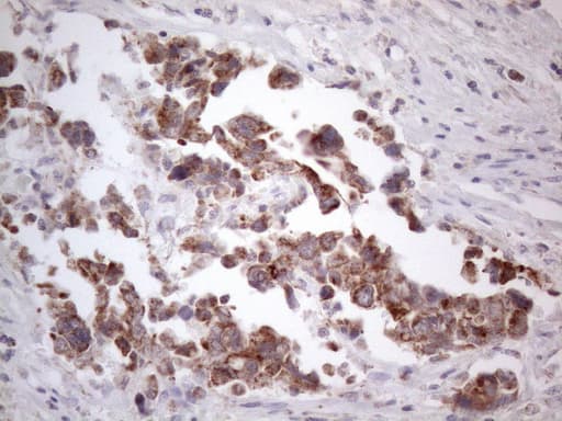 Monoclonal Mouse anti-Human RORB / ROR Beta Antibody (clone OTI1G1, aa1-260, IHC, WB)