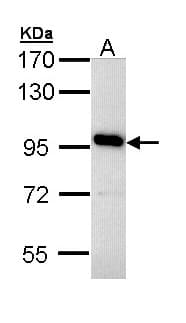 IHC-plus™ ATP6V0A4 Antibody (aa53-295)