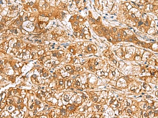 HRSP12 / UK114 Antibody