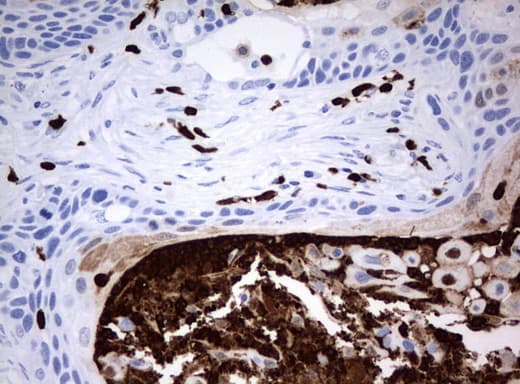 Monoclonal Mouse anti-Human PBX1 Antibody (clone UMAB111, IHC, IF)