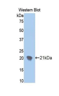 ENPP1 Antibody (aa625-780, FITC)
