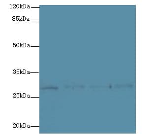 CHAC1 / MGC4504 Antibody