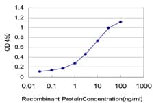 Monoclonal Mouse anti-Human PPP3R1 / Calcineurin B Antibody (clone 4E1, IF, WB)