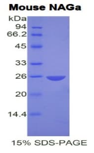 Mouse NAGA Protein (Recombinant His)