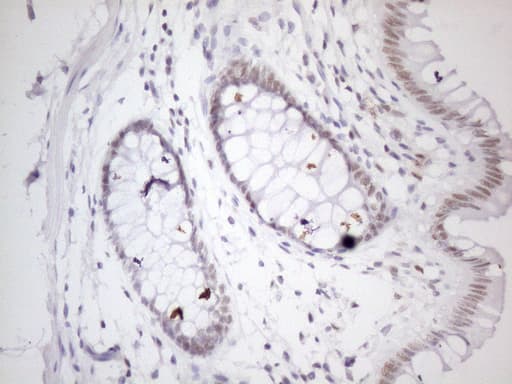 Monoclonal Mouse anti-Human PRPK / TP53RK Antibody (clone OTI5G7, IHC, WB)