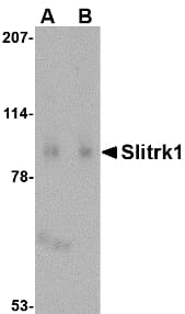 IHC-plus™ Polyclonal Rabbit anti-Human SLITRK1 Antibody (IHC, IF, WB)
