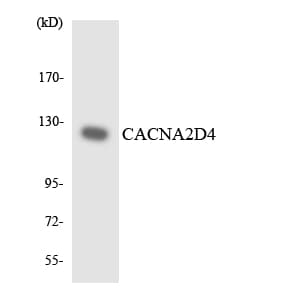 CACNA2D4 Antibody (aa535-584)