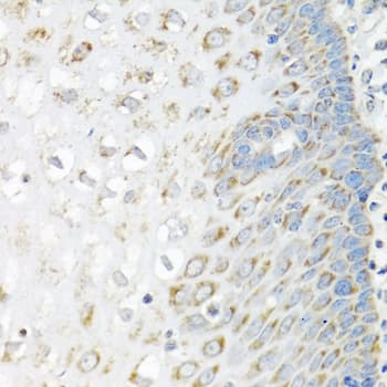 Polyclonal Rabbit anti-Human IMP-3 / IGF2BP3 Antibody (IHC, WB)